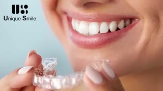 ارتودنسی نامرئی | دکتر عطایی
