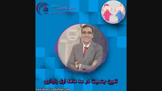تعیین جنسیت جنین در اوایل بارداری