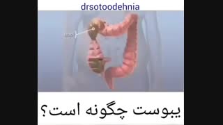 یبوست چگونه است ؟