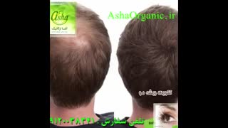 روغن سیاهدانه دکتر زرقانی