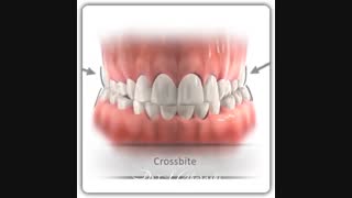 دستگاه اکسپندر | دکتر قریشی