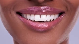 تغییر شکل دندان | دکتر سعید قریشی