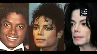 علت تغییر رنگ پوست مایکل جکسون .....