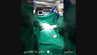 زایمان سزارین توسط دکتر ندا مقتدری هایفوتراپی