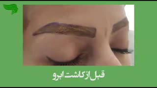 فیلم کاشت ابرو
