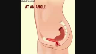 نشستن روی توالت فرنگی
