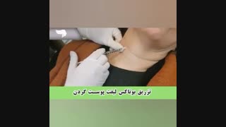 فیلم لیفت گردن