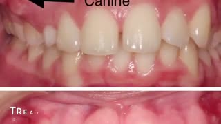 فیلم نمونه های ارتودنسی دو فک|کلینیک دندانپزشکی مدرن