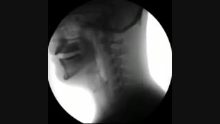 اب خوردن در مقابل اشعه ایکس