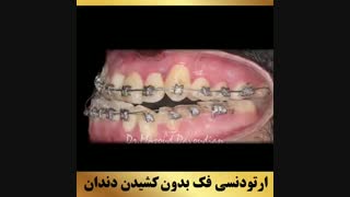 دکتر داودیان | متخصص ارتودنسی