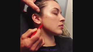 مراحل قبل از زاویه سازی صورت | کلینیک زیبایی تسنیم