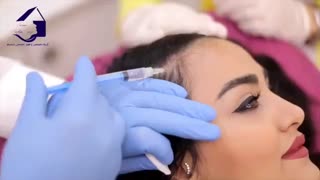مزوتراپی مو | کلینیک زیبایی تسنیم