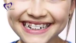 سن ویزیت ارتودنسی | دکتر فیروزی
