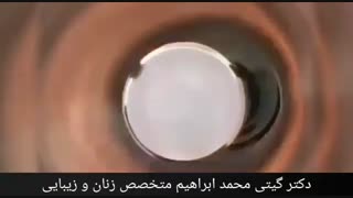 تنگ کردن واژن چگونه انجام می شود؟