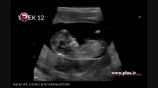 معرفی تست تشخیص جنسیت جنین از خون مادر از هفته8بارداری