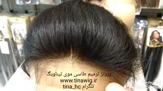 پروتز ترمیم طاسی و کم پشتی موی بانوان مخصوص جلومو و بالای سر - فروشگاه اینترنتی تیناویگ