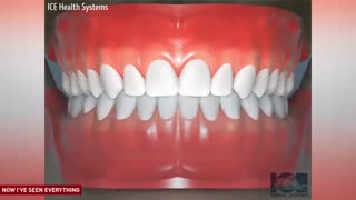 درمان های مختلف ارتودنسی به صورت انیمیشن|کلینیک  دندانپزشکی مدرن