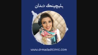 بلیچینگ دندان کشیدن دندان