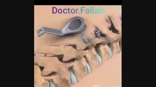 جراحی ستون فقرات