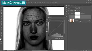 از بین بردن جوش، کک و مک