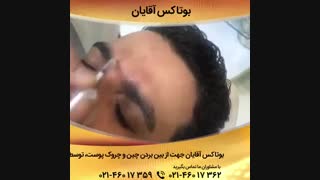 فیلم بوتاکس در مردان