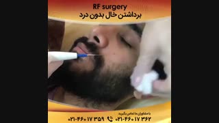 برداشتن خال بدون درد