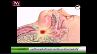 انسداد تنفس در میان رانندگان