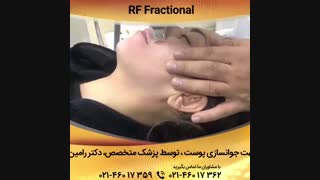 فیلم جوانساری پوست با آر اف