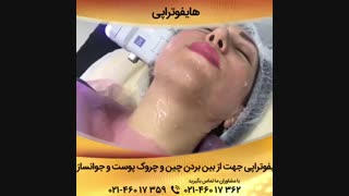 فیلم هایفوتراپی