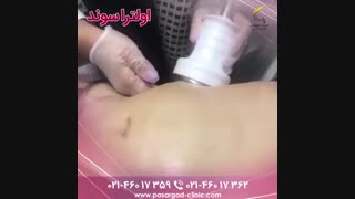 لاغری شکم بدون جراحی