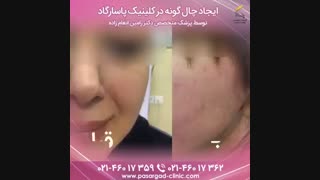 کلینیک زیبایی چال گونه