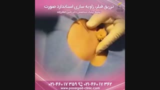 زاویه سازی صورت با تزریق ژل