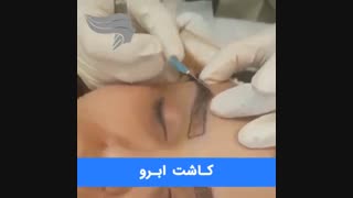 فیلم کاشت ابروی طبیعی