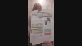 بازم معجزه ی تجربه یکی از هموطنان تهرانی مون ۱۱% افزایش_تراکم_استخوان