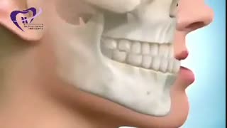 جراحی فک | دکتر فیروزی