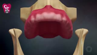 پروتز بر پایه ایمپلنت | کلینیک دندانپزشکی بهمن