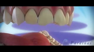 ونیر | کلینیک دندانپزشکی تاج