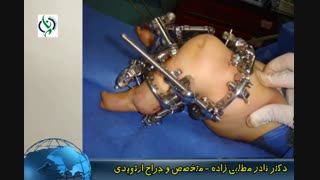نجات از قطع عضو