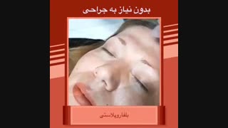 بلفاروپلاستی لیفت گردنایمپلنت دندان