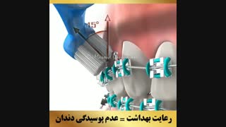 متخصص ارتودنسی | دکتر داودیان
