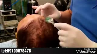 درمارولر سر وصورت|09190678478|