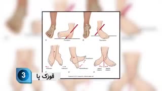 چند تمرین برای کاهش دردپا در خانه