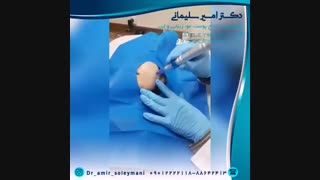 میکرونیدلینگ برای چه افرادی مناسب است ؟