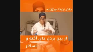 از بین بردن جای آکنه و اسکار با میکرونیدلینگ کلینیک پوست