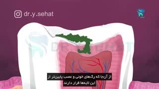 چگون دندان خراب می‌شود، دکتر یداله صحت، جراح دندانپزشک گرگان