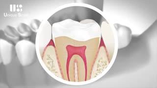 ترمیم دندان آسیب دیده | دکتر لیلا عطایی