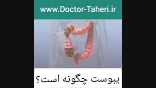 یبوست چگونه است؟ | دکتر امیر طاهری