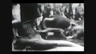 بهروز وثوقی جراحی پف زیر چشم