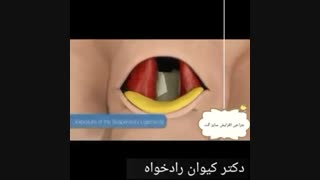 جراحی افزایش سایز آلت