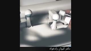 درمان سرطان مثانه